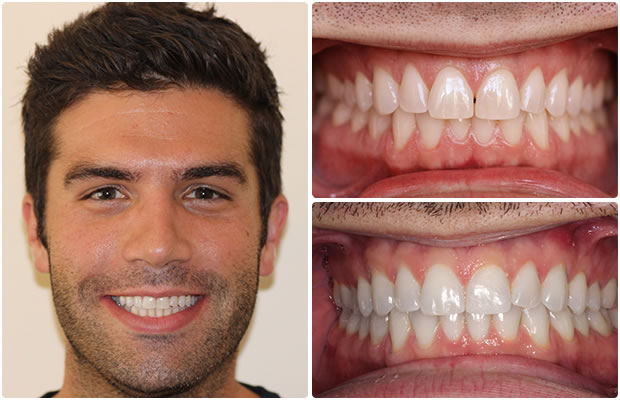 Cosmetic Dentistry in San Francisco Image 3