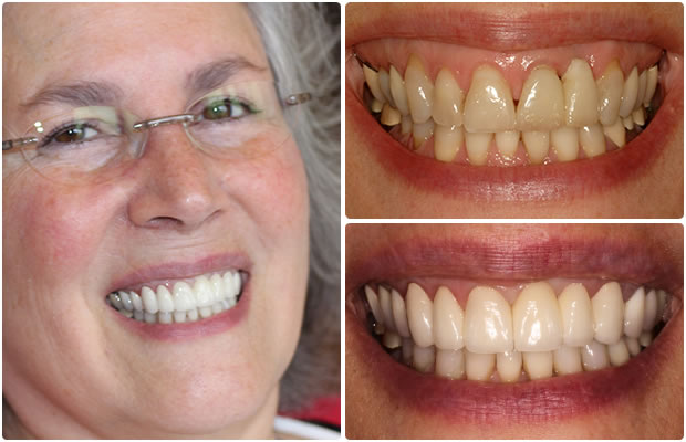 Cosmetic Dentistry in San Francisco Image 5