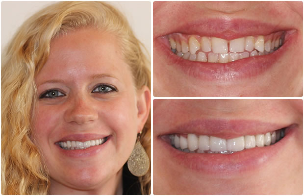 Cosmetic Dentistry in San Francisco Image 1