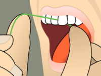 Flossing Your Teeth Step 3