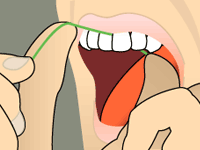 Flossing Your Teeth Step 4